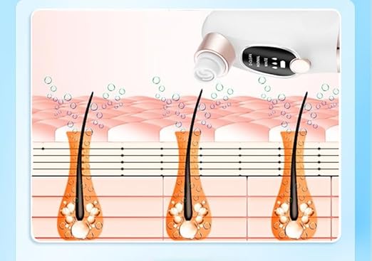 Blackhead Suction Pore Cleaner, 6 Suction Heads, 3 Modes, USB Charging Facial Cleansing, Pick Vacuum Cleaner, Device Blackhead Remover