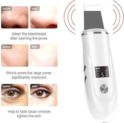 Beauenty Ultrasonic Skin Scrubber Face Spatula, Skin Spatula Pore Cleaner, Skin Dirt Blackhead Remover Tools for Facial Deep Cleansing - 4 Modes (B)